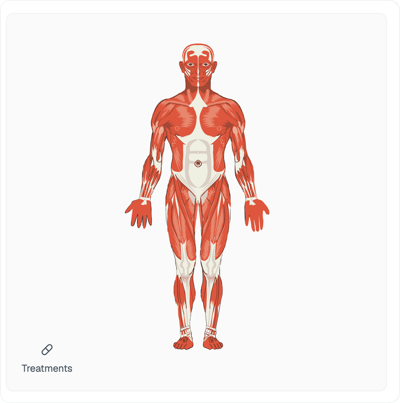 Body chart for marking treatment areas