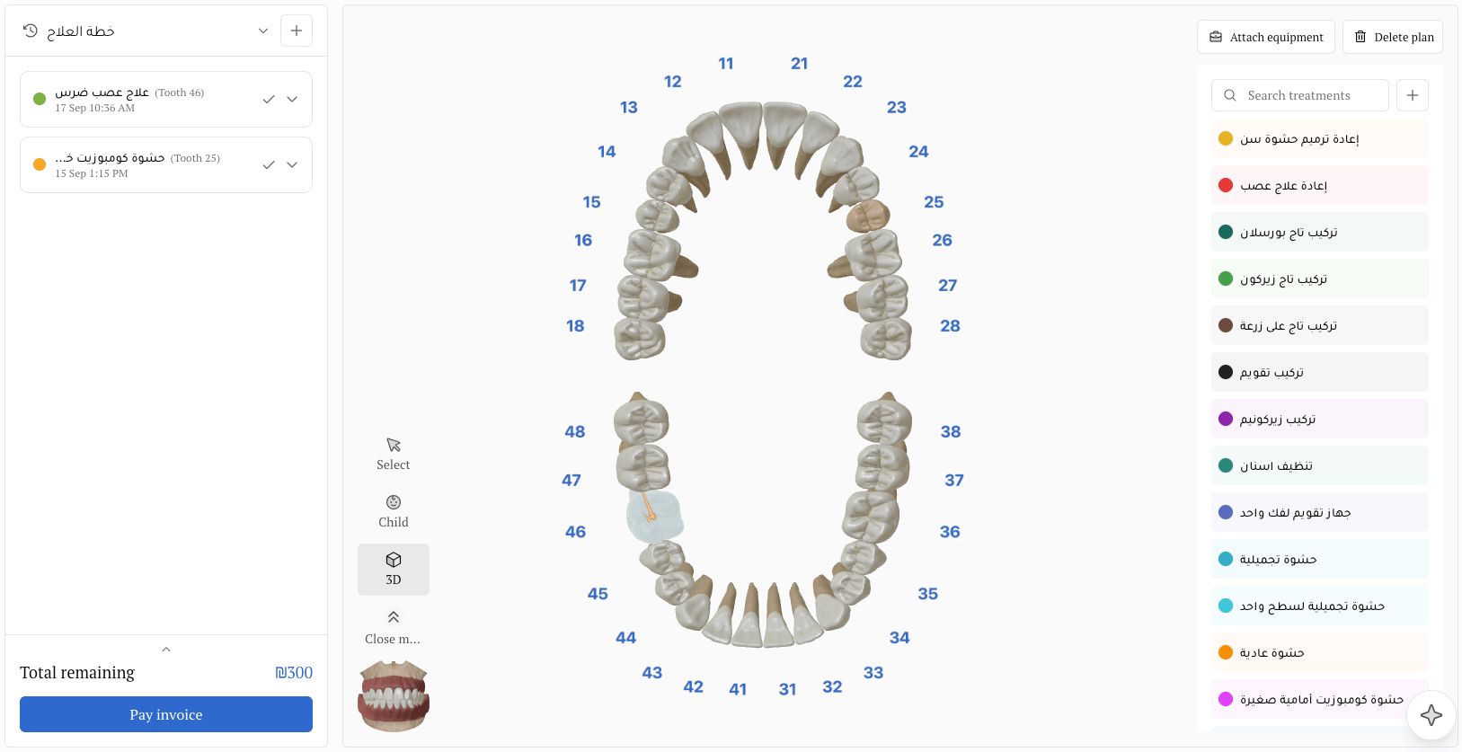 3D teeth chart with a treatment list