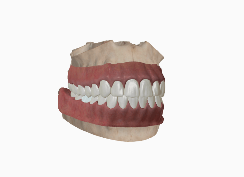 3D jaw model