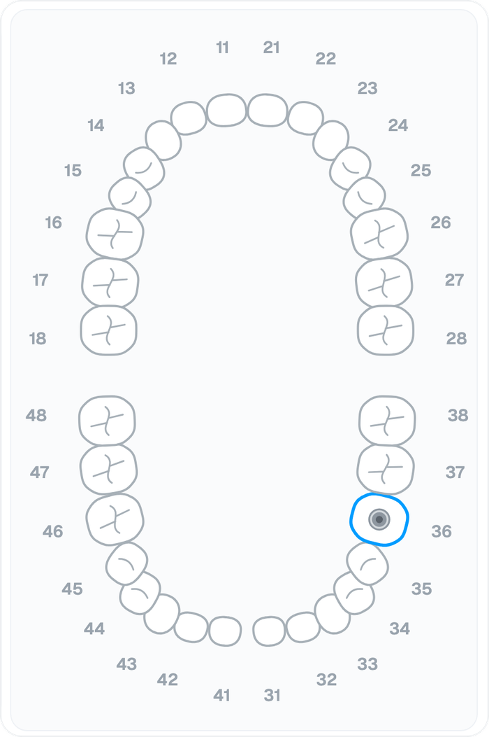 2D teeth chart