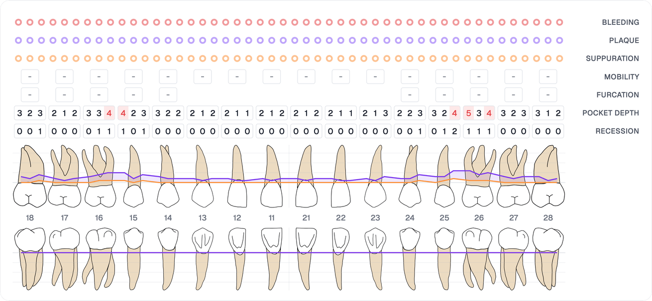 Periodontal chart