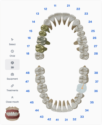 3D teeth chart with the chart tools