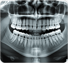 Panoramic X-ray